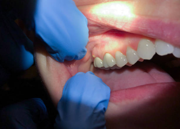 Best Emergency Dentist for Special Needs Patients in Packanack Lake, NJ